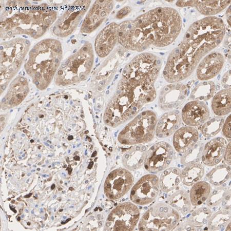 HUABIO HA722748 image 2