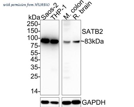 HUABIO HA722751 image 2