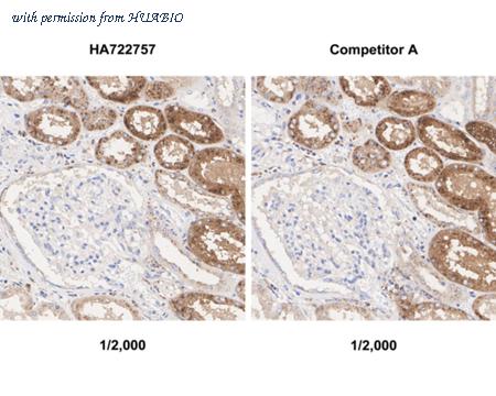 HUABIO HA722757 image 2