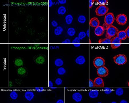 HUABIO HA722772 image 3