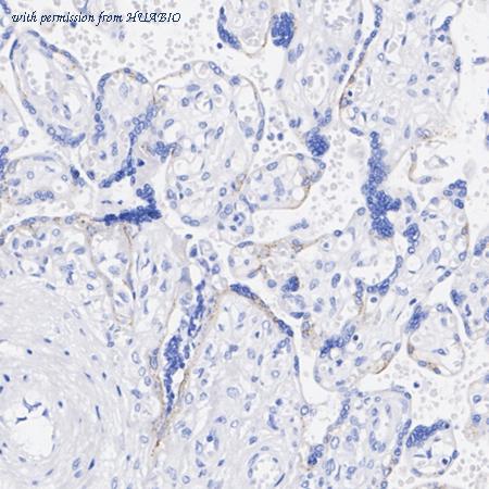 HUABIO HA722834 image 3