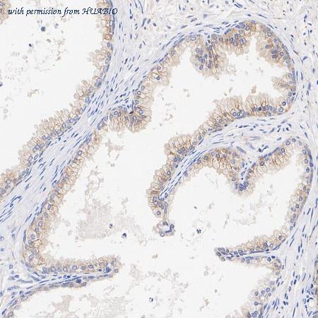 HUABIO HA722861 image 3