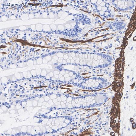 HUABIO HA722863 image 2