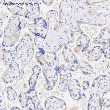 HUABIO HA722864 image 3