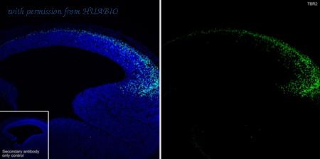 HUABIO HA722918 image 1