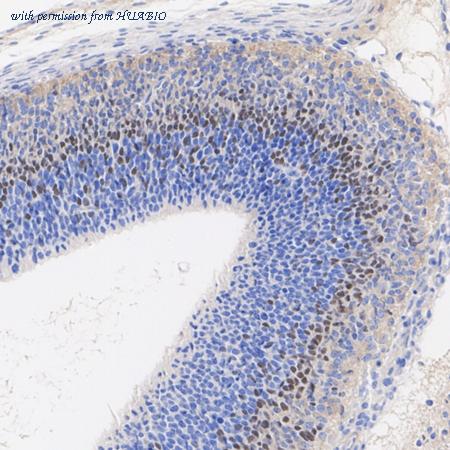 HUABIO HA722918 image 2