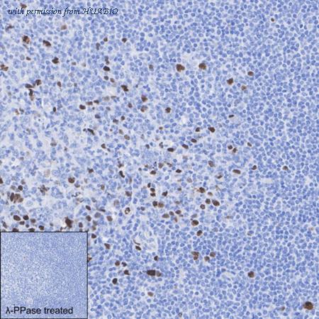 HUABIO HA722942 image 2