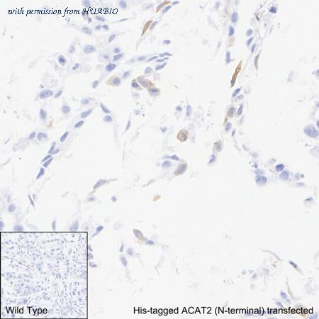 HUABIO HA722965 image 2