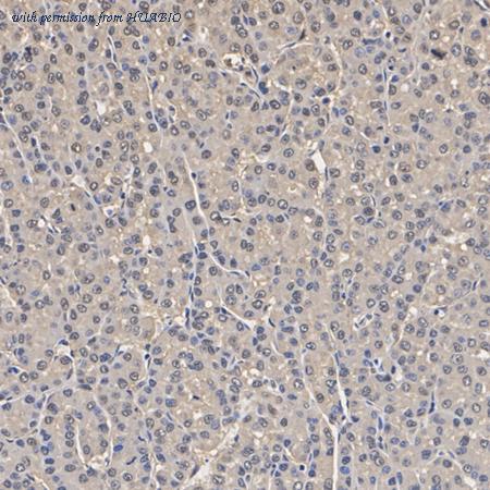 HUABIO HA722996 image 3