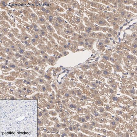 HUABIO HA722998 image 3