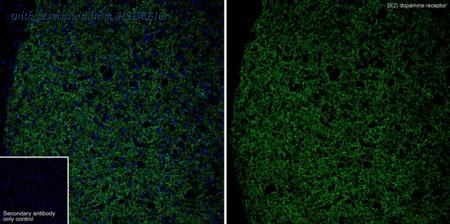 HUABIO HA723163 image 1