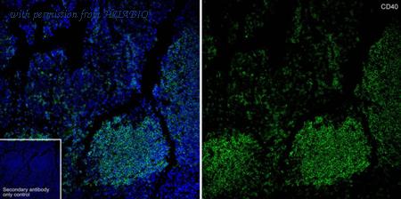 HUABIO HA723170 image 3