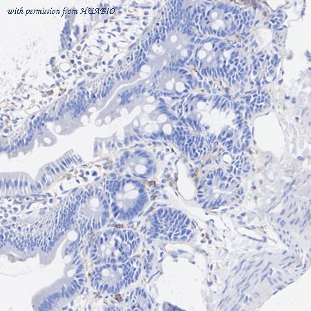 HUABIO HA723182 image 3