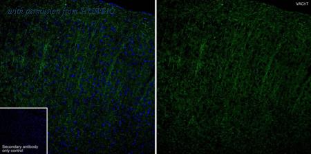 HUABIO HA723214 image 1