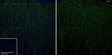 HUABIO HA723214 image 2