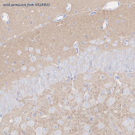 HUABIO HA723226 image 3