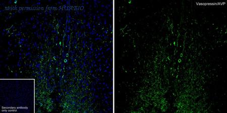 HUABIO HA723360 image 1