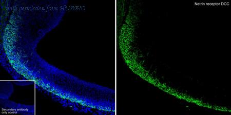 HUABIO HA723484 image 3