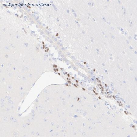 HUABIO HA723536 image 1