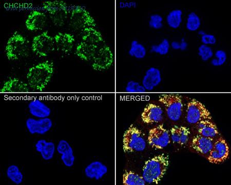 HUABIO HA723580 image 2