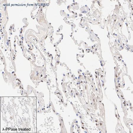 HUABIO HA723663 image 2