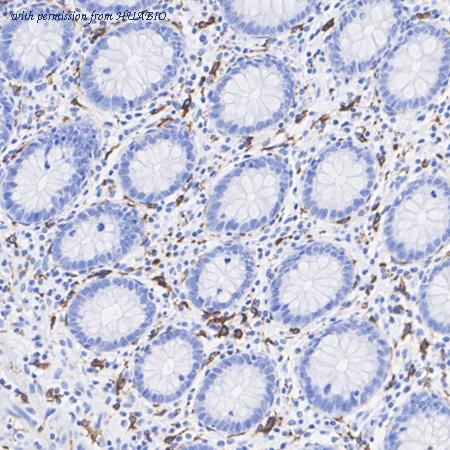 HUABIO HA723706 image 1