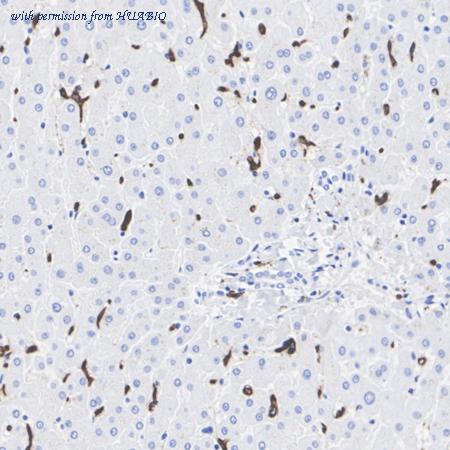 HUABIO HA723706 image 2