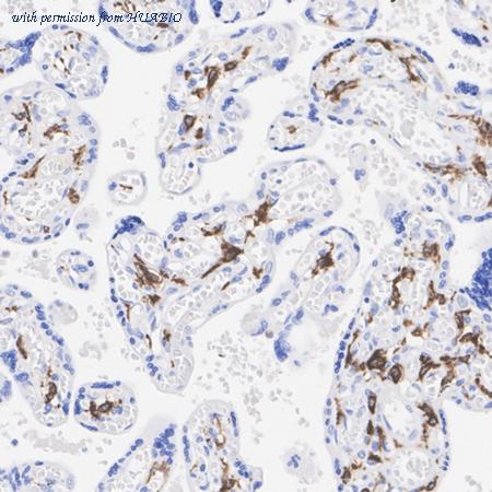 HUABIO HA723706 image 3