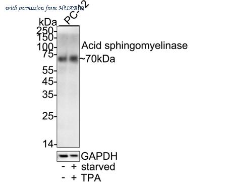 HUABIO HA723768 image 2