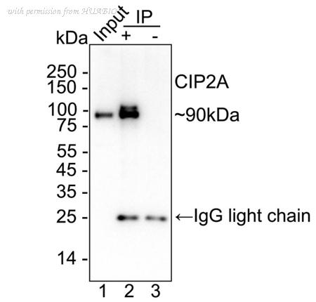 HUABIO HA723817 image 2