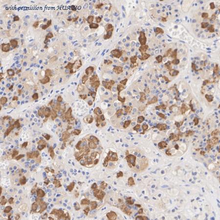 HUABIO HA723822 image 1