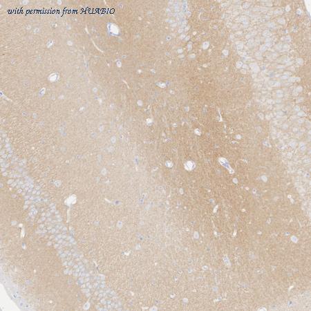 HUABIO HA723915 image 3