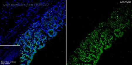 HUABIO HA723917 image 3