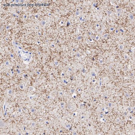 HUABIO HA723923 image 3