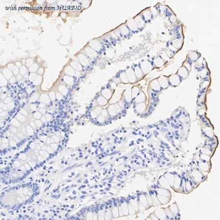 HUABIO HA723952 image 1