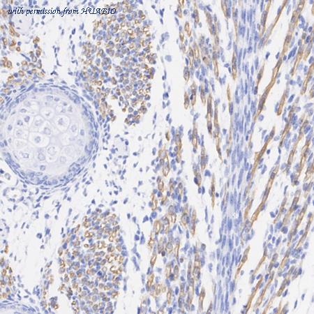 HUABIO HA723975 image 3