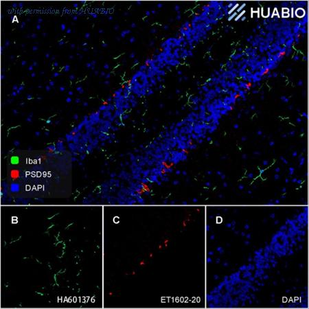 HUABIO HA750035 image 1