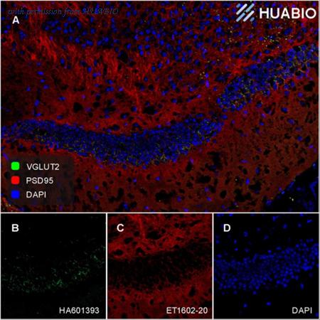 HUABIO HA750035 image 2