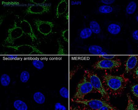 HUABIO HA750043 image 2