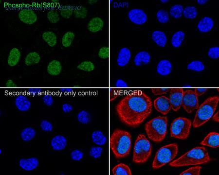 HUABIO HA750045 image 3