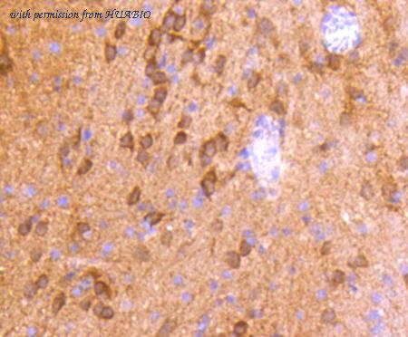 HUABIO HA750150 image 3