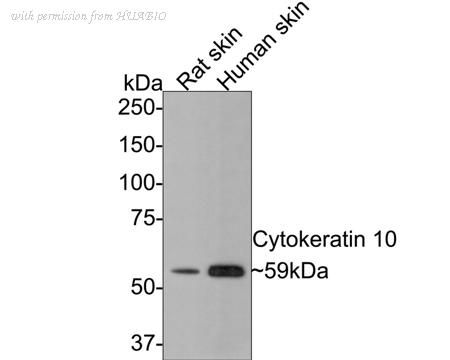 HUABIO HA750193 image 1
