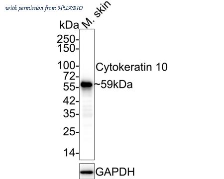 HUABIO HA750193 image 2