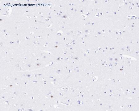 HUABIO HA750200 image 3