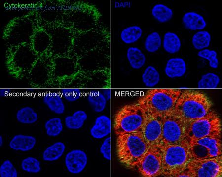 HUABIO HA750271 image 1