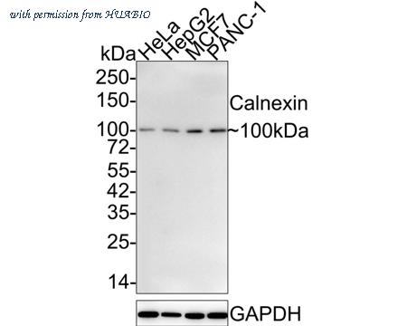 HUABIO HA750275 image 1