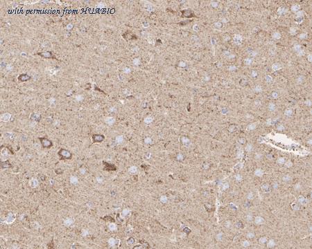 HUABIO HA750314 image 2