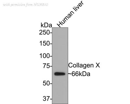 HUABIO HA750336 image 2