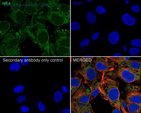 HUABIO HA750355 image 2