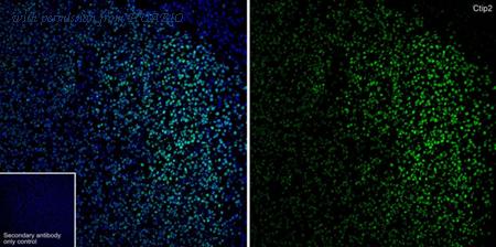 HUABIO HA750358 image 1